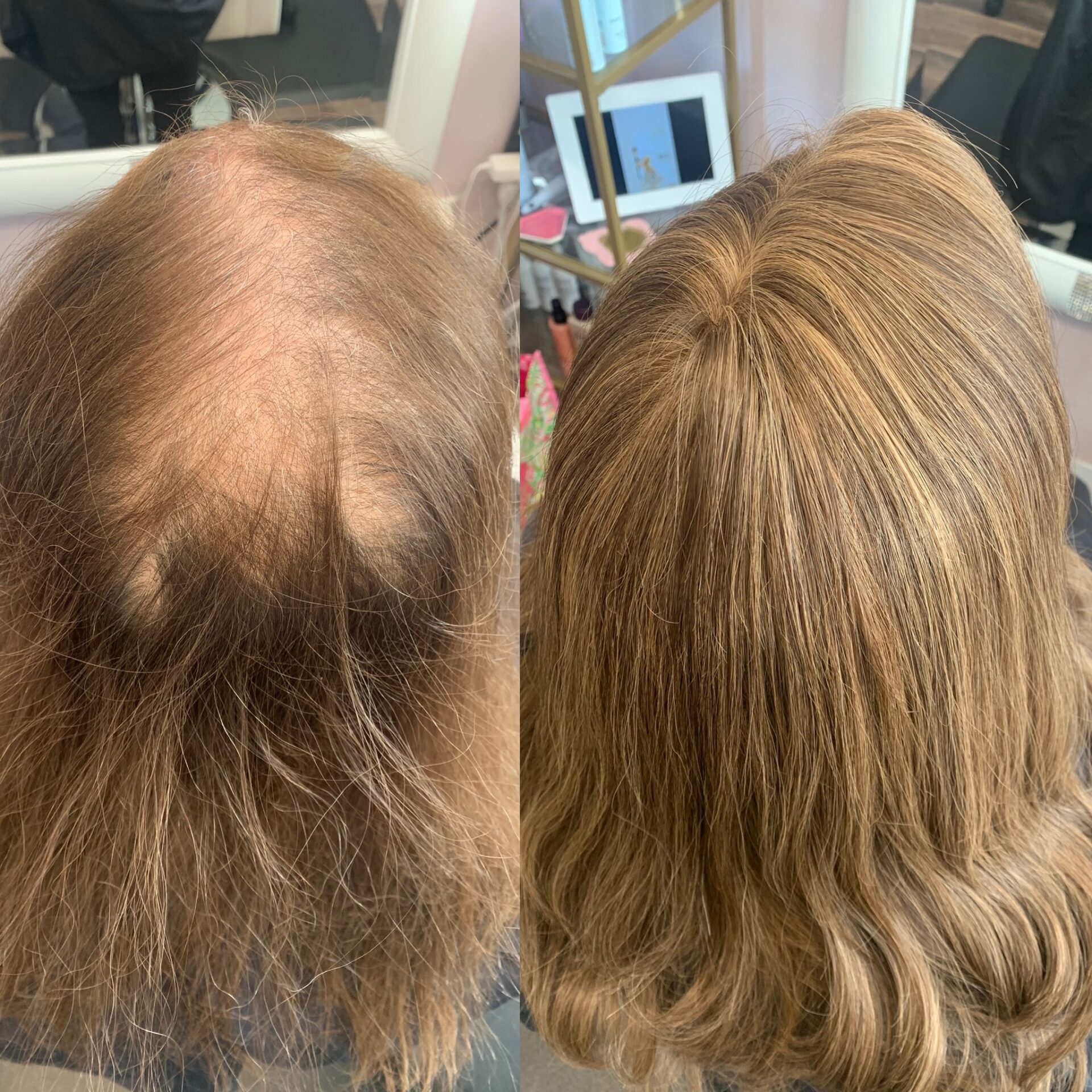 Hair Extensions After Chemo at Glo Extensions in Denver