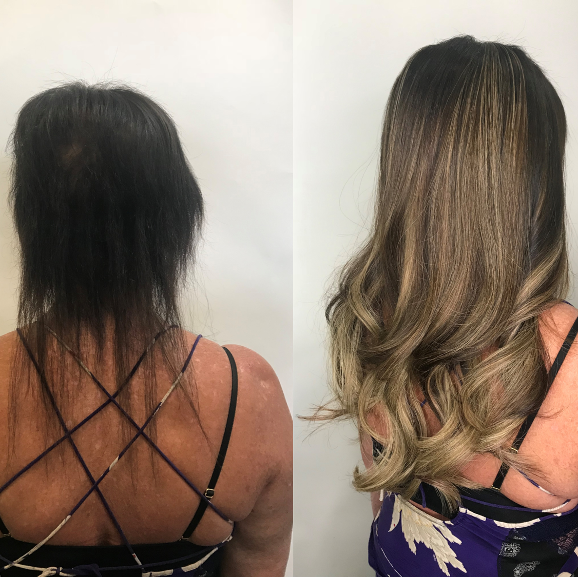 hair extensions thinning hair and hair loss Denver