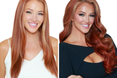 Before & Afters Transparent  - 15