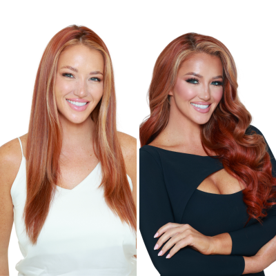 Before & Afters Transparent  - 15